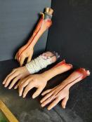 Severed Arms